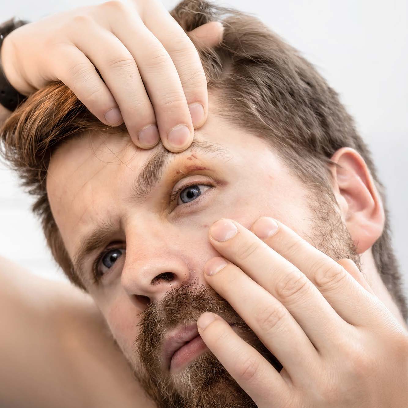 Disturbi degli occhi