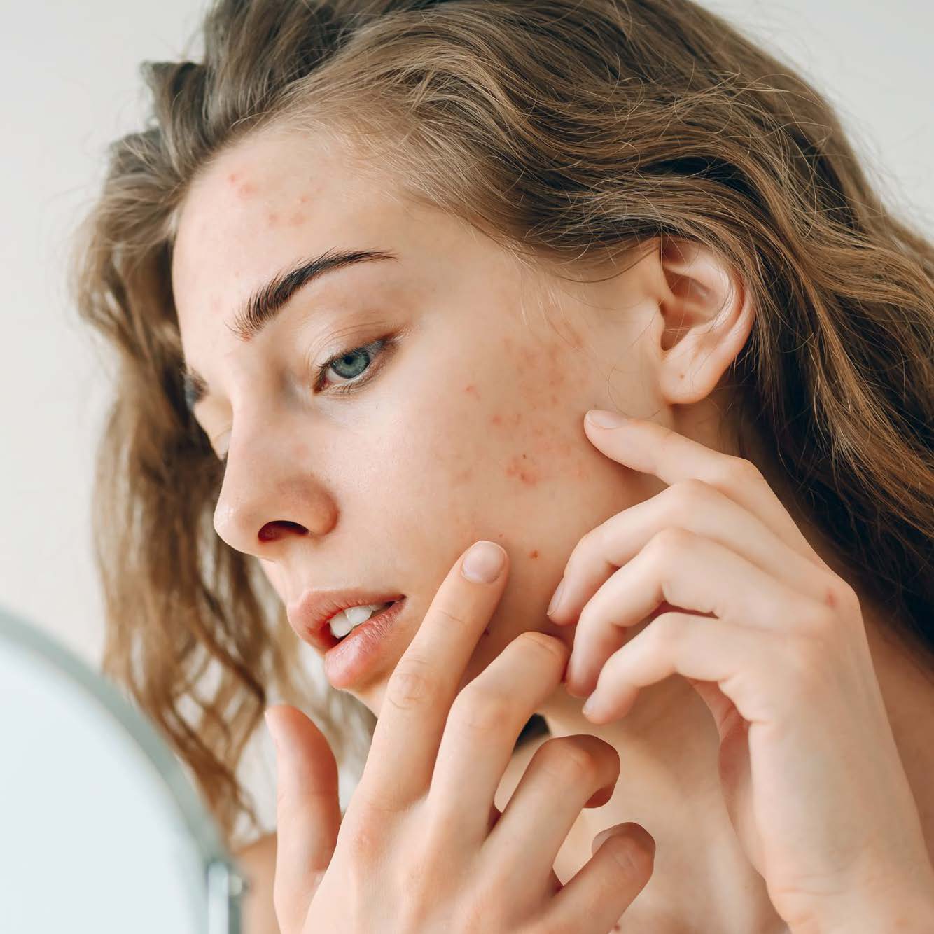 Problemi della pelle